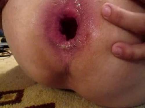 Dildo Anal – Kinky webcam very close colossal anal gaping