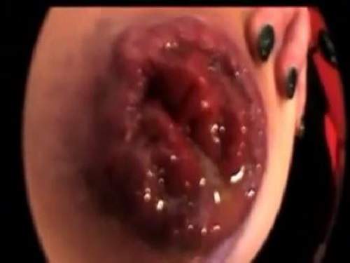 Close Up – Unique mature homemade training her epic size prolapse anus