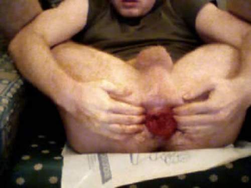 Gay Rosebutt – Webcam man bloody fisting anal and rosebutt ass