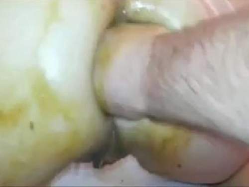 anal shit fisting amateur