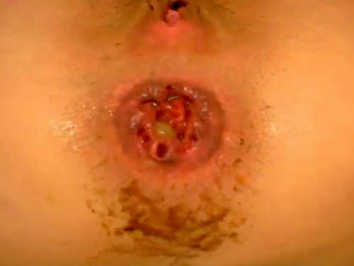 Webcam Scat – Young teen shitting anal rosebutt and gape loose closeup