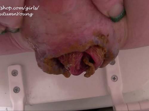 Anal Prolapse – AutumnYoung scat prolapse stretching closeup – Release June 12, 2017