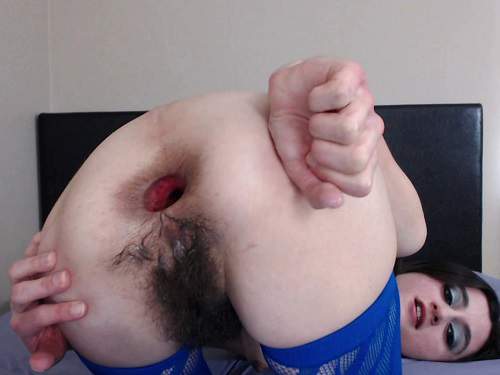 Hairy Ass Fisting