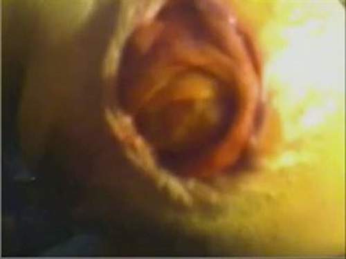 Prolapse Ass – Sexy webcam wife giant prolapse anus stretching closeup