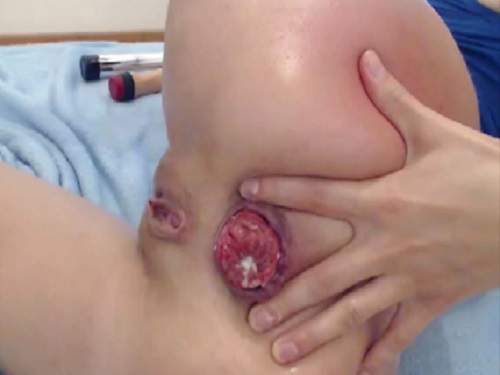 Webcam – Stunning rectal prolapse booty slut webcam