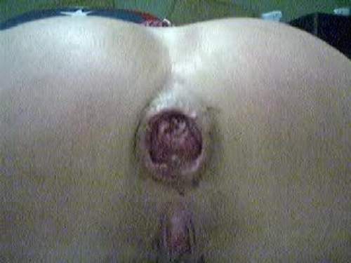 Mature ass hole close up