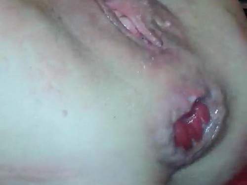 Closeup – Vaginal fisting and zucchini penetrated into rosebutt anu