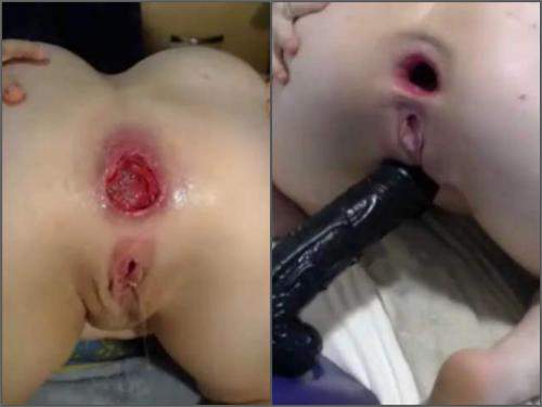 Huge Dildo – Webcam big ass girl insertion dildo in huge prolapse and gape