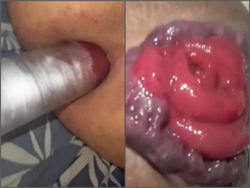 Webcam – Amateur male HungryAss_1992 pump her giant prolapse anal