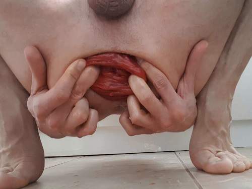 Male Anal – Amateur male hardcore stretching his giant anal prolapse