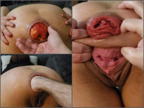 VixenxMoon hard anal destruction fisting and gaping,VixenxMoon anal prolapse,VixenxMoon anal porn,VixenxMoon anal fisting,deep fisting,apple anal,apple in ass,vegetable porn,pussy prolapse,farting