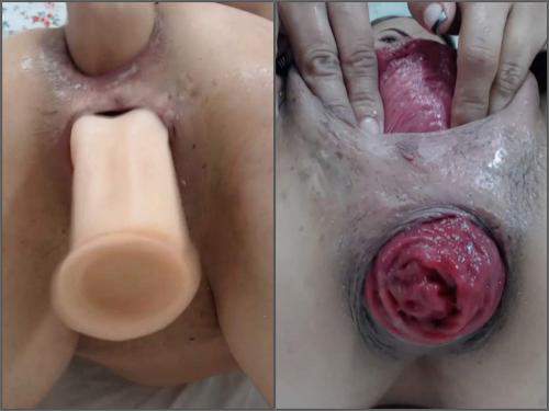 Dildo Anal – Carolinauribe again anal prolapse and pussy ruined