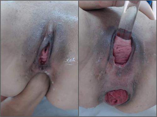 Solo Fisting – Webcam latina Carolinauribe cervix stretching and loose prolapse anal hardcore