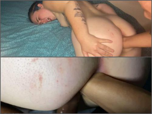 Anal Fisting – Booty teen double penetration and rough anal fisting sex