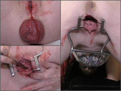 Anal Prolapse – Bloody period speculum examination with dirty brunette