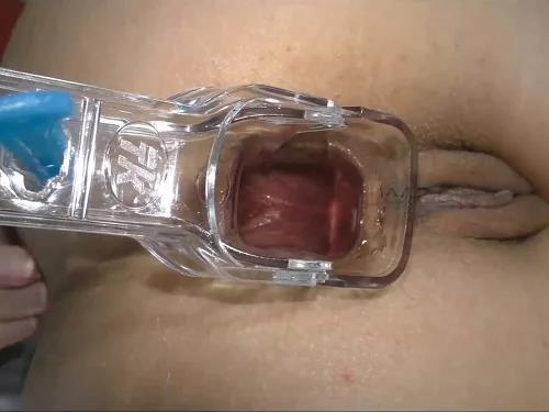 Solo fisting – German blonde Helena Moeller try speculum anal examination close-up