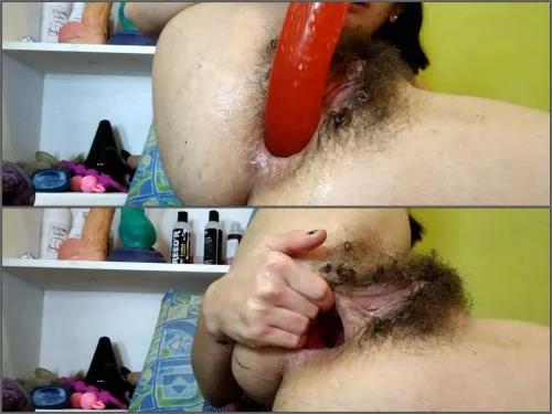 Anal prolapse – Hairy cute girl Pipaypipo big anus hole prolapse and gape terror