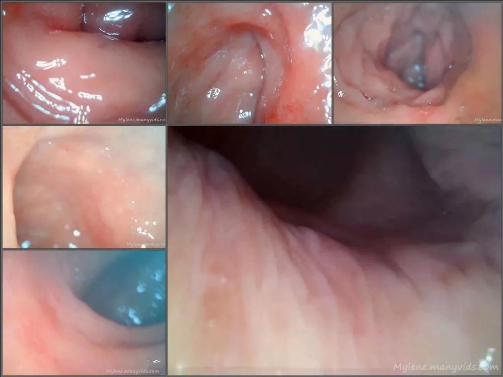 Anal depth endoscopy,medical porn,medical fetish,endoscope porn,amateur closeup