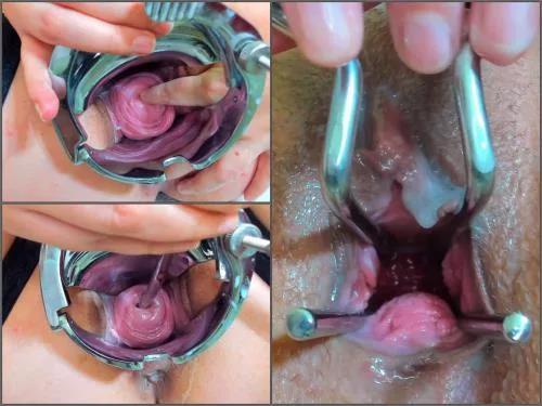 Pussy prolapse – Andradahot Medical Inspection inside my Cervix closeup – Premium user Request