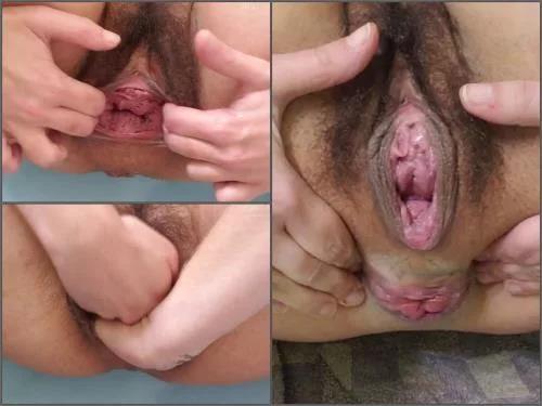 Rosebutt loose – Hairy teen Vixenxmoon stretched pussy prolapse and anal rosebutt – Premium user Request