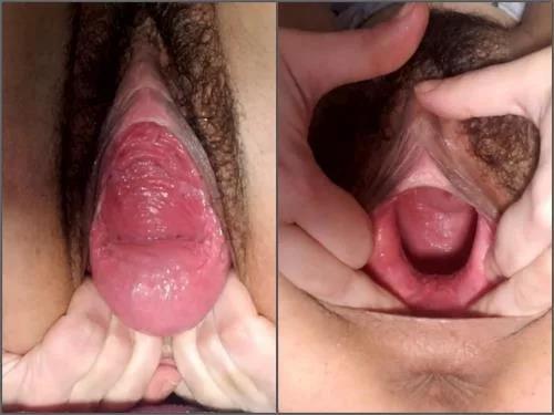 Closeup – Dirty hairy teen Vixenxmoon penetration tunnel plug in pussy prolapse