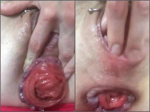 Prolapse – Natus Amare Shameless slut stretches her meaty prolapsing holes webcam