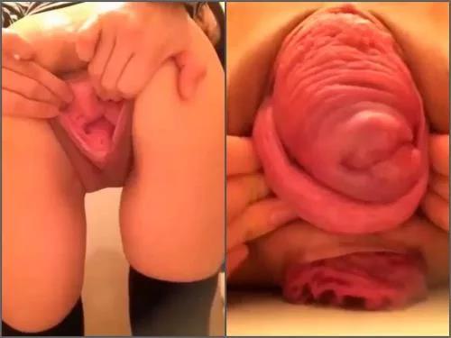 Asian – Amazing compilation with huge pussy and anal prolapse stretching from japanese girl