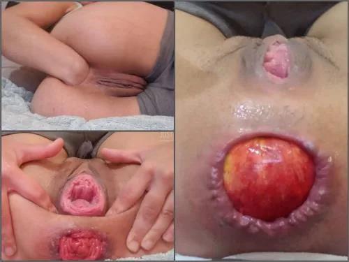 Prolapse porn – Webcam perverted teen Vixenxmoon gets big red apple fully in anal prolapse